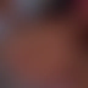 ✨