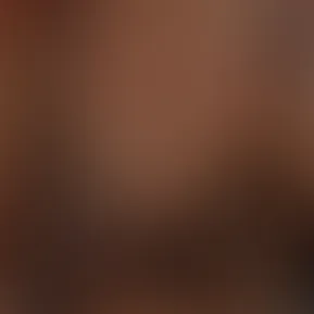 v12044gd0000d87nm57og65ih7p4ovk0.mp4