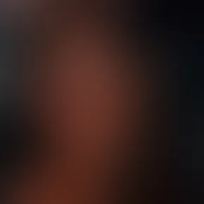blurred lines