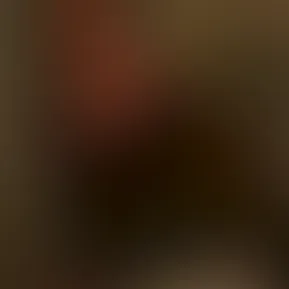 Jiggle
