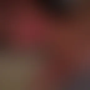 💋