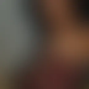 staring contest (spoilers I win)